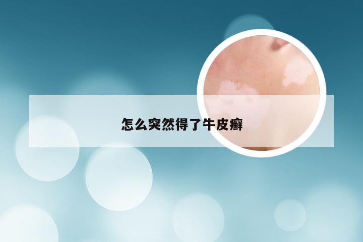 怎么突然得了牛皮癣