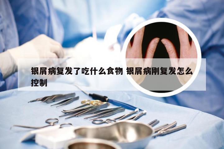 银屑病复发了吃什么食物 银屑病刚复发怎么控制