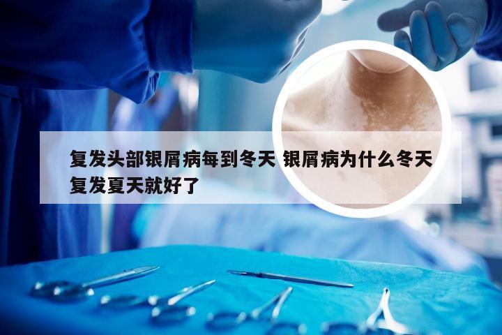 复发头部银屑病每到冬天 银屑病为什么冬天复发夏天就好了