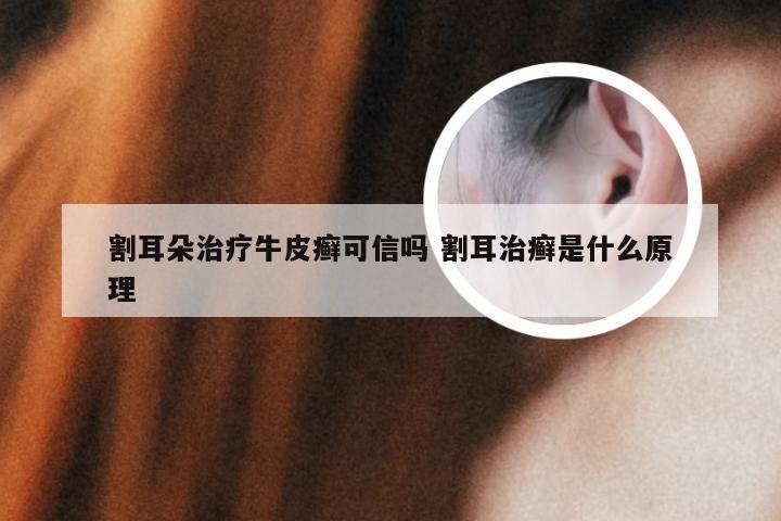 割耳朵治疗牛皮癣可信吗 割耳治癣是什么原理