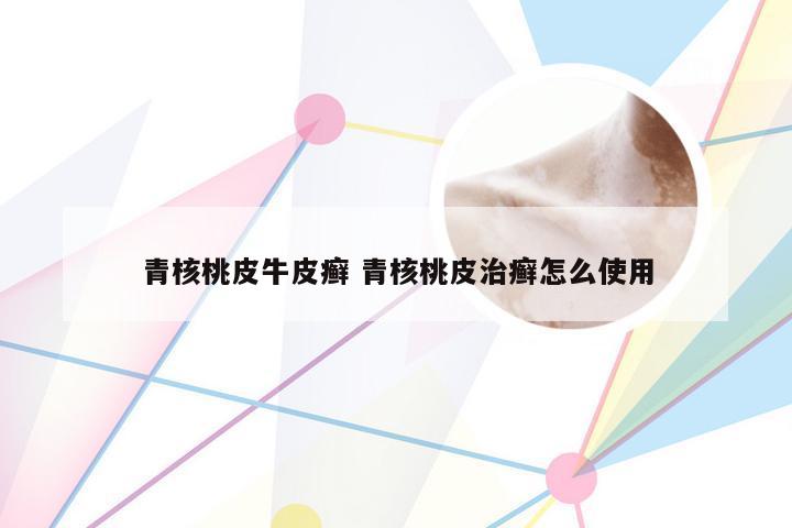 青核桃皮牛皮癣 青核桃皮治癣怎么使用
