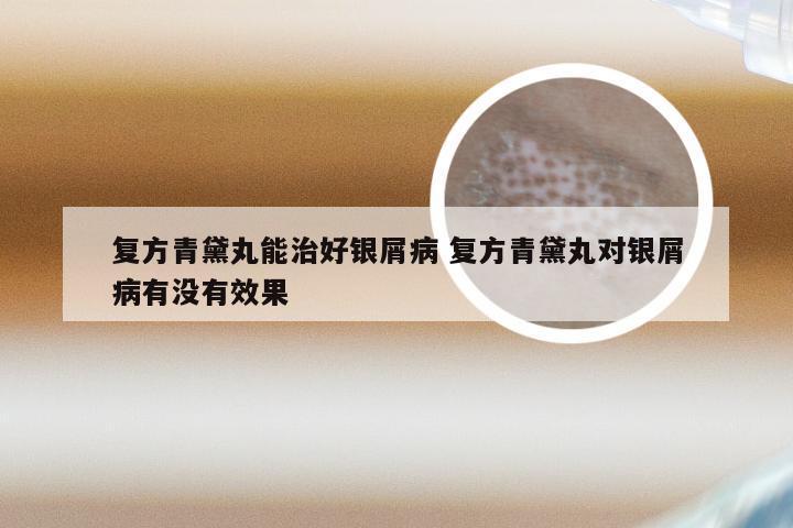 复方青黛丸能治好银屑病 复方青黛丸对银屑病有没有效果
