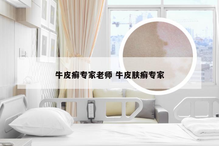 牛皮癣专家老师 牛皮肤癣专家