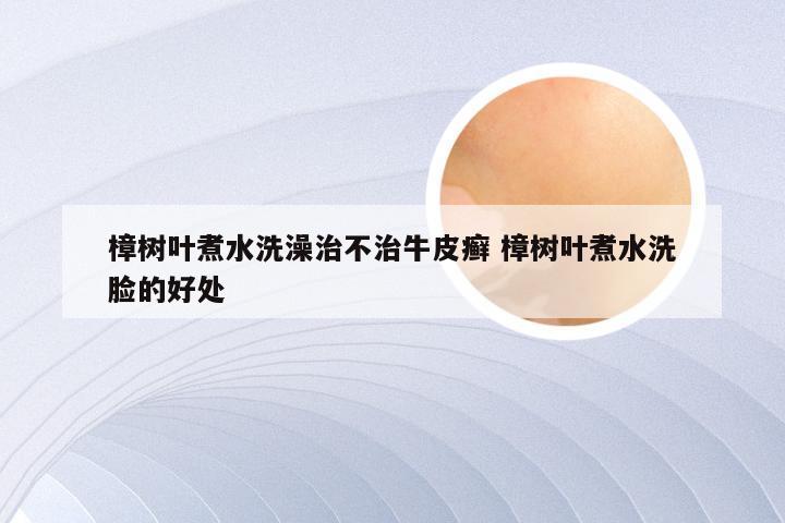 樟树叶煮水洗澡治不治牛皮癣 樟树叶煮水洗脸的好处