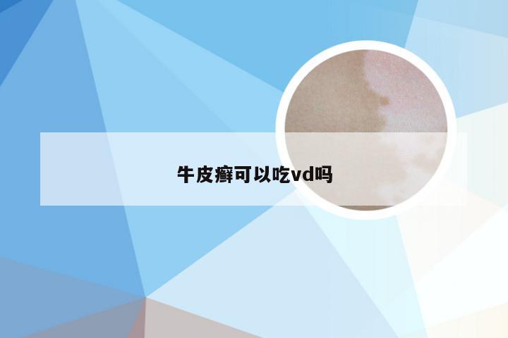 牛皮癣可以吃vd吗