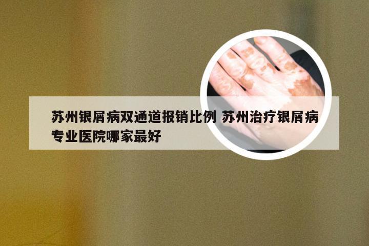 苏州银屑病双通道报销比例 苏州治疗银屑病专业医院哪家最好