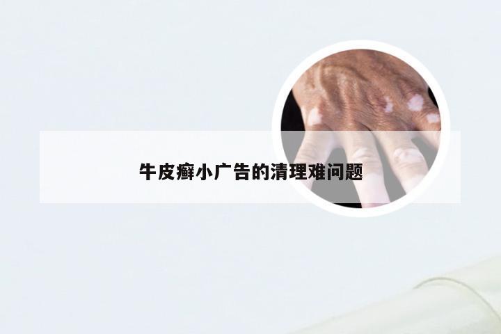牛皮癣小广告的清理难问题