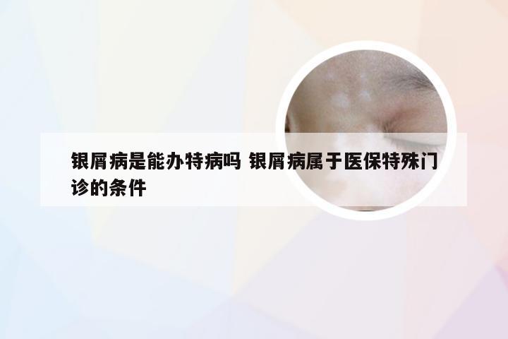 银屑病是能办特病吗 银屑病属于医保特殊门诊的条件
