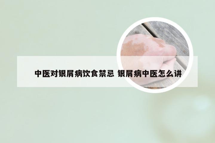 中医对银屑病饮食禁忌 银屑病中医怎么讲
