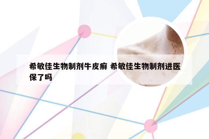 希敏佳生物制剂牛皮癣 希敏佳生物制剂进医保了吗