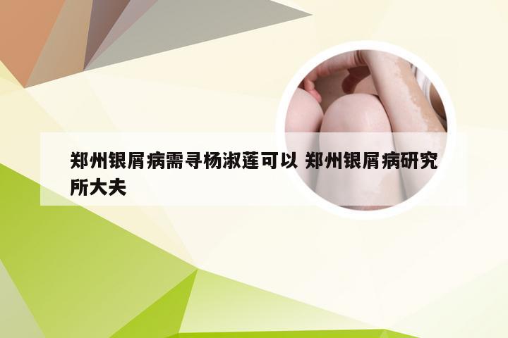 郑州银屑病需寻杨淑莲可以 郑州银屑病研究所大夫