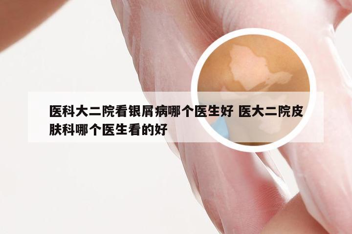 医科大二院看银屑病哪个医生好 医大二院皮肤科哪个医生看的好