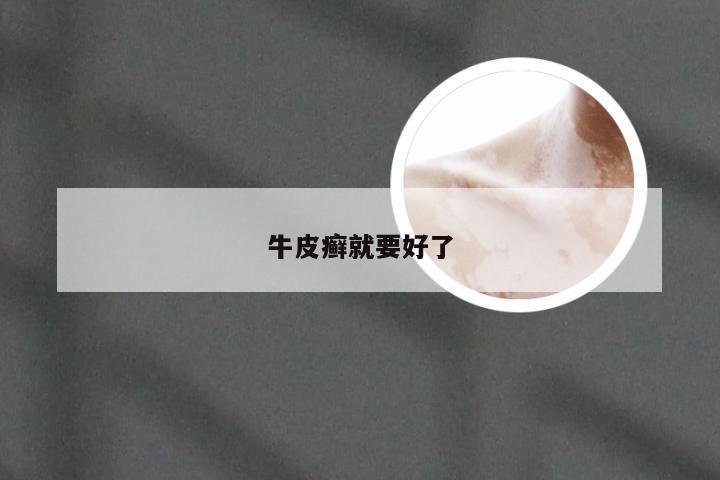 牛皮癣就要好了
