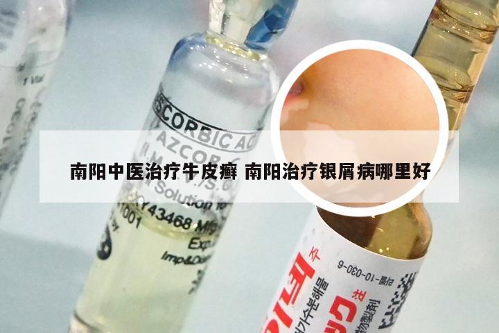 南阳中医治疗牛皮癣 南阳治疗银屑病哪里好
