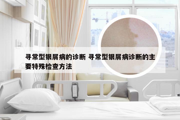 寻常型银屑病的诊断 寻常型银屑病诊断的主要特殊检查方法