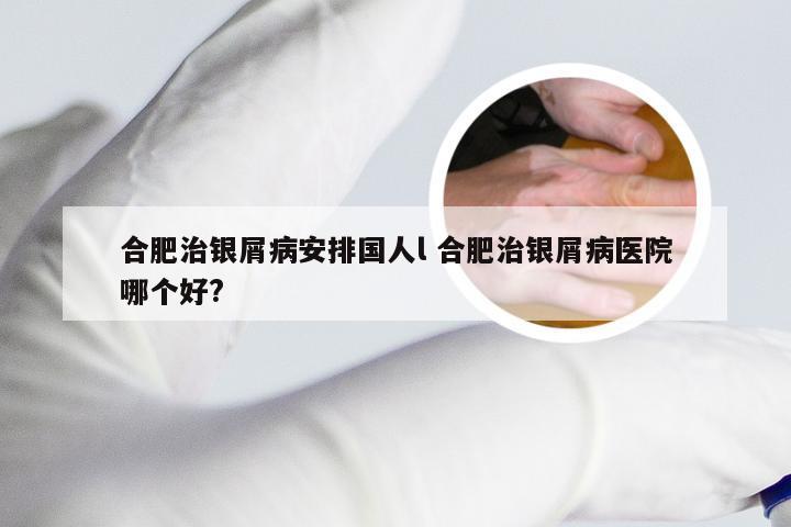合肥治银屑病安排国人l 合肥治银屑病医院哪个好?