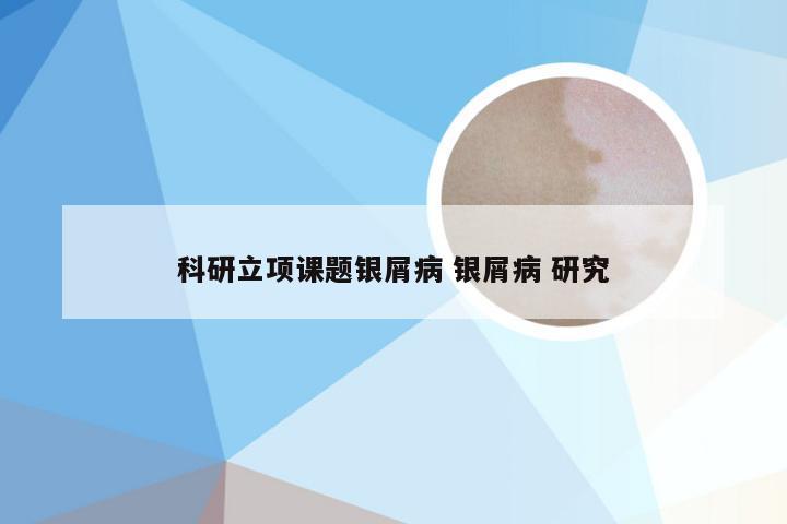 科研立项课题银屑病 银屑病 研究