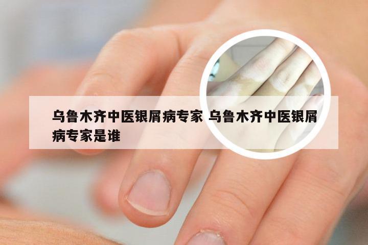 乌鲁木齐中医银屑病专家 乌鲁木齐中医银屑病专家是谁