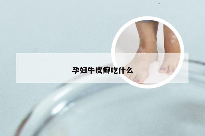 孕妇牛皮癣吃什么