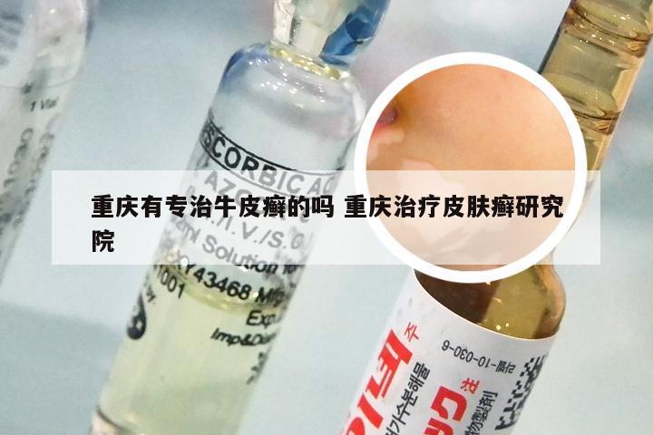 重庆有专治牛皮癣的吗 重庆治疗皮肤癣研究院
