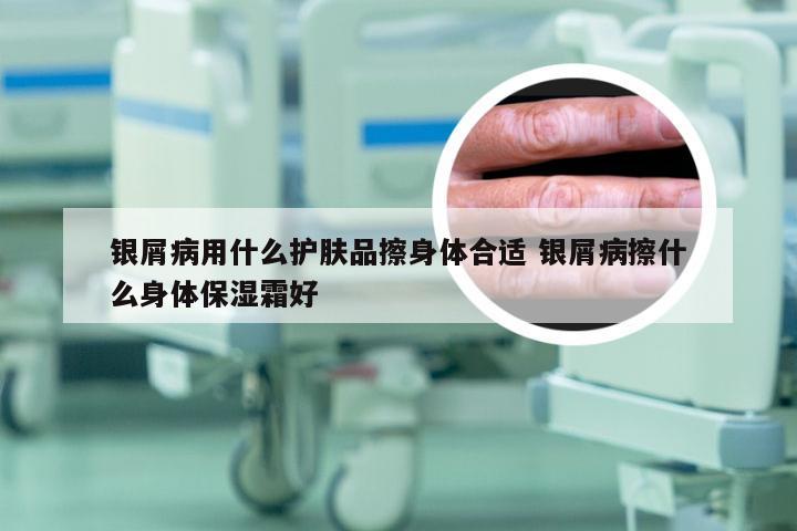 银屑病用什么护肤品擦身体合适 银屑病擦什么身体保湿霜好