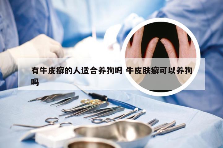 有牛皮癣的人适合养狗吗 牛皮肤癣可以养狗吗