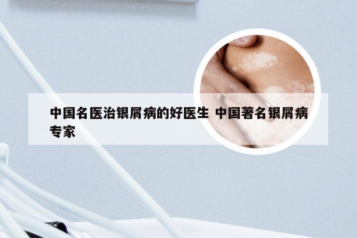 中国名医治银屑病的好医生 中国著名银屑病专家