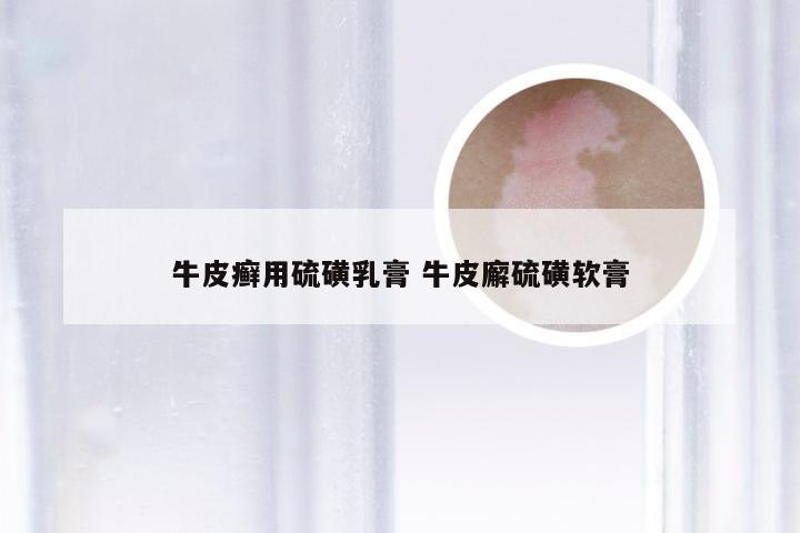 牛皮癣用硫磺乳膏 牛皮廨硫磺软膏
