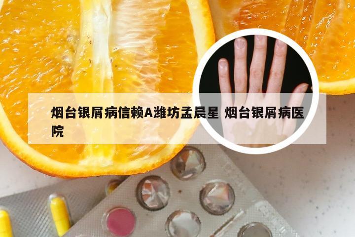 烟台银屑病信赖A潍坊孟晨星 烟台银屑病医院