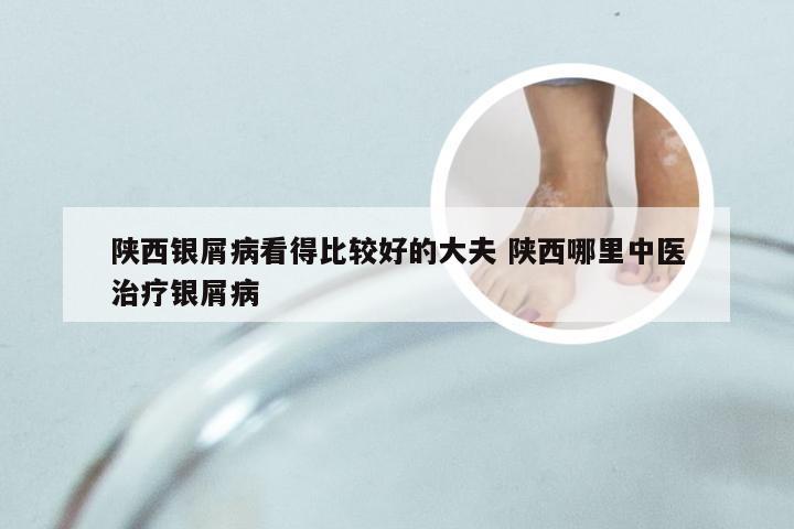 陕西银屑病看得比较好的大夫 陕西哪里中医治疗银屑病