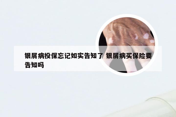 银屑病投保忘记如实告知了 银屑病买保险要告知吗
