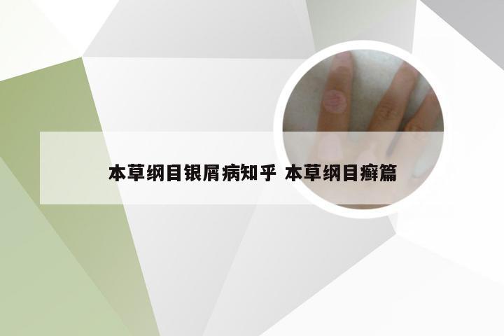 本草纲目银屑病知乎 本草纲目癣篇