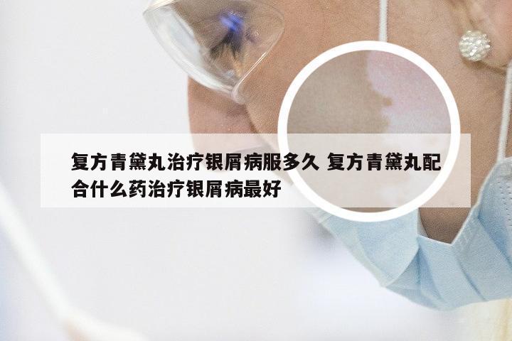 复方青黛丸治疗银屑病服多久 复方青黛丸配合什么药治疗银屑病最好