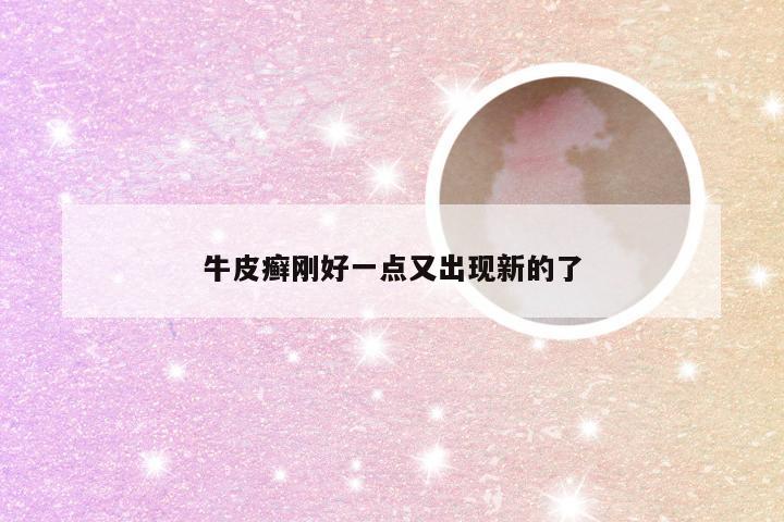 牛皮癣刚好一点又出现新的了
