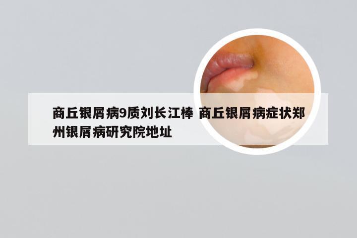 商丘银屑病9质刘长江棒 商丘银屑病症状郑州银屑病研究院地址