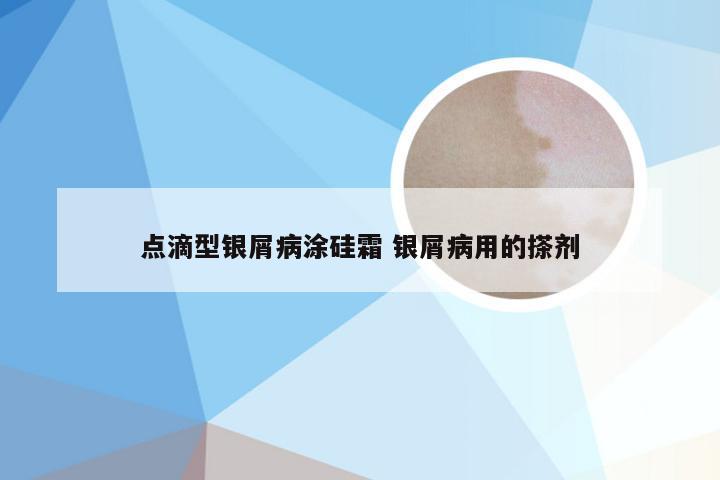 点滴型银屑病涂硅霜 银屑病用的搽剂