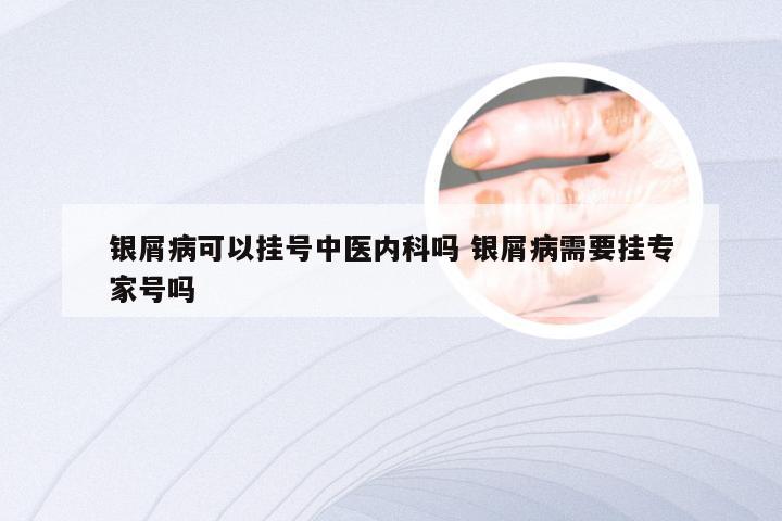 银屑病可以挂号中医内科吗 银屑病需要挂专家号吗