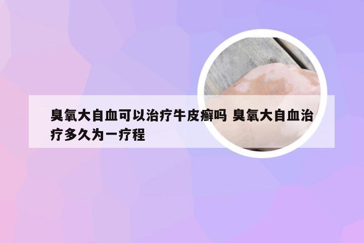 臭氧大自血可以治疗牛皮癣吗 臭氧大自血治疗多久为一疗程