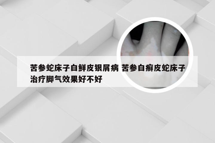 苦参蛇床子白鲜皮银屑病 苦参白癣皮蛇床子治疗脚气效果好不好