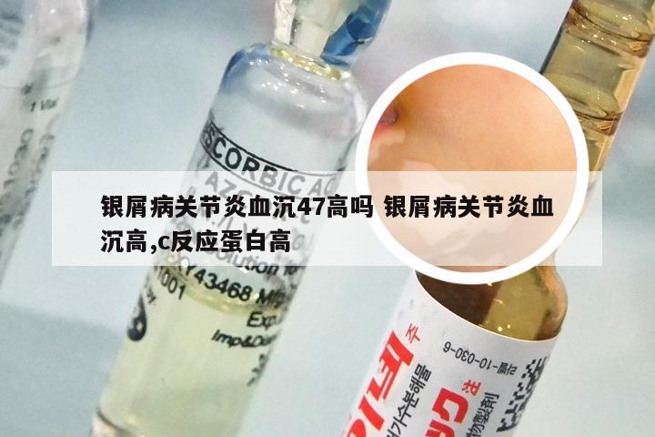 银屑病关节炎血沉47高吗 银屑病关节炎血沉高,c反应蛋白高