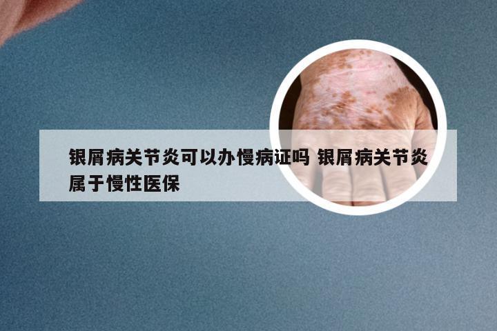 银屑病关节炎可以办慢病证吗 银屑病关节炎属于慢性医保