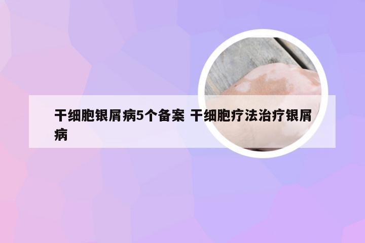 干细胞银屑病5个备案 干细胞疗法治疗银屑病