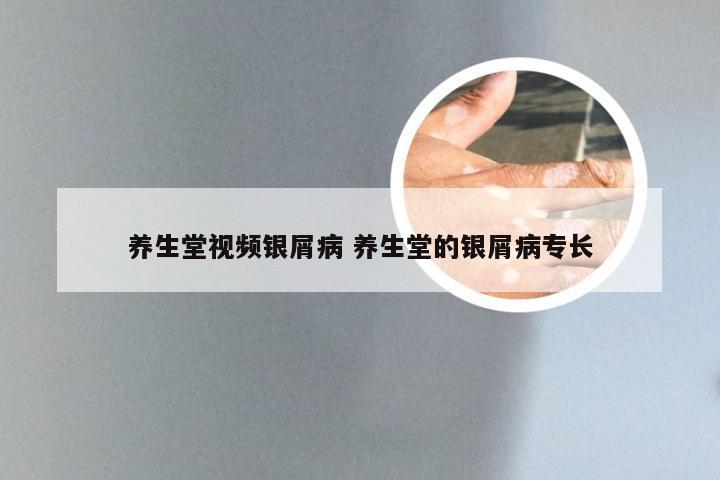 养生堂视频银屑病 养生堂的银屑病专长