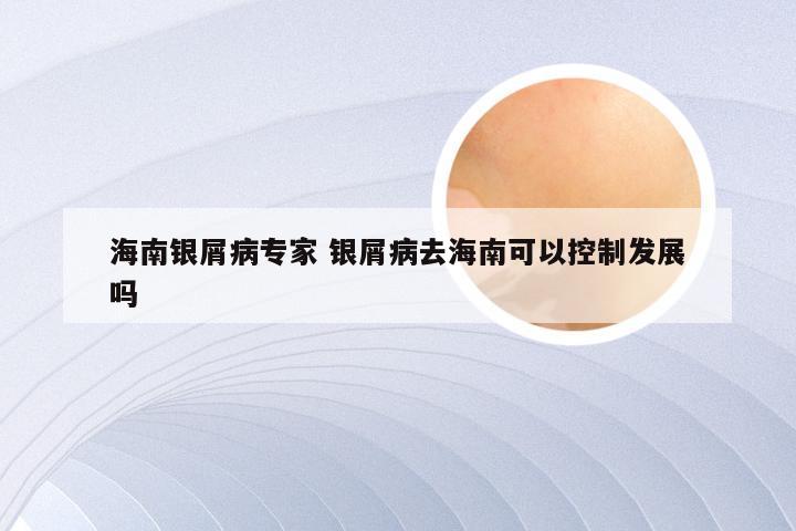 海南银屑病专家 银屑病去海南可以控制发展吗