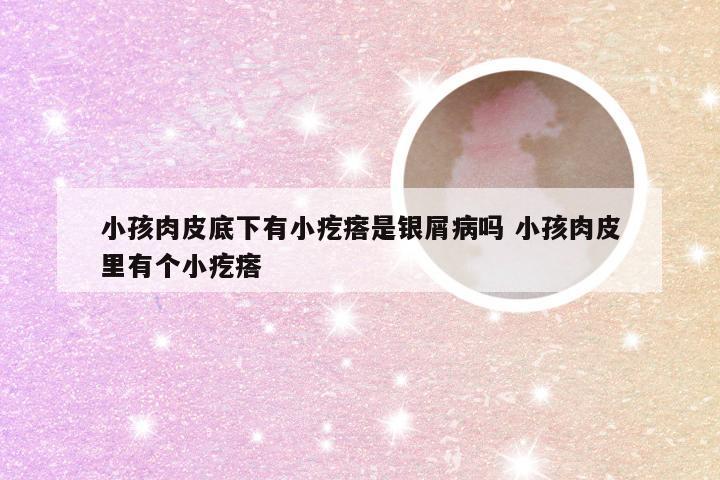 小孩肉皮底下有小疙瘩是银屑病吗 小孩肉皮里有个小疙瘩