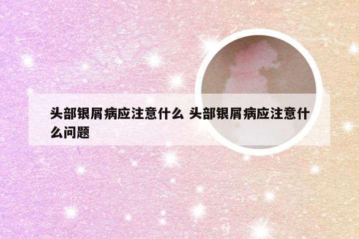 头部银屑病应注意什么 头部银屑病应注意什么问题