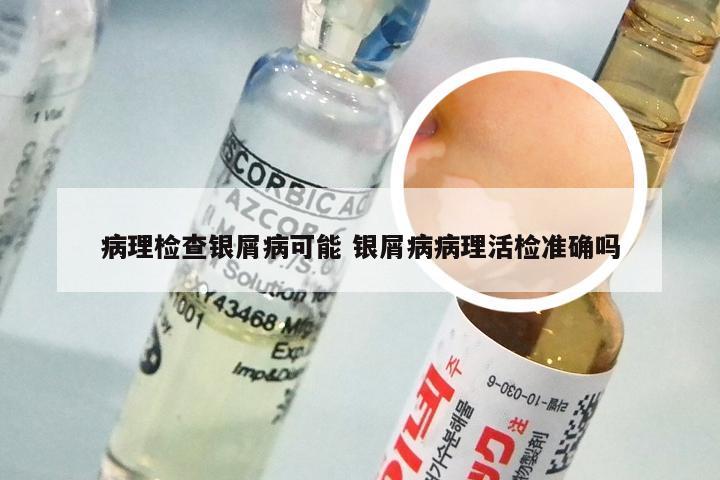 病理检查银屑病可能 银屑病病理活检准确吗