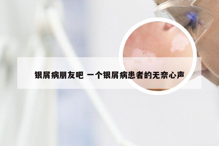 银屑病朋友吧 一个银屑病患者的无奈心声