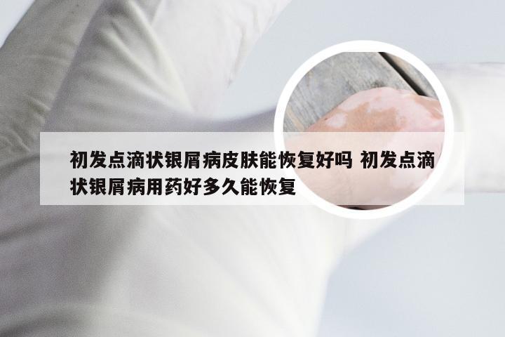 初发点滴状银屑病皮肤能恢复好吗 初发点滴状银屑病用药好多久能恢复