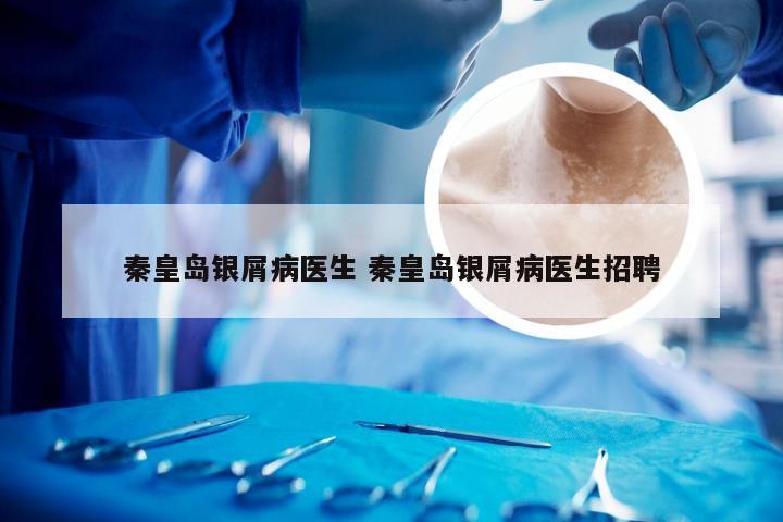 秦皇岛银屑病医生 秦皇岛银屑病医生招聘